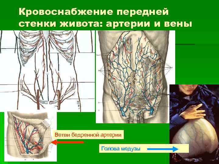 Кровоснабжение передней стенки живота: артерии и вены Ветви бедренной артерии Голова медузы 