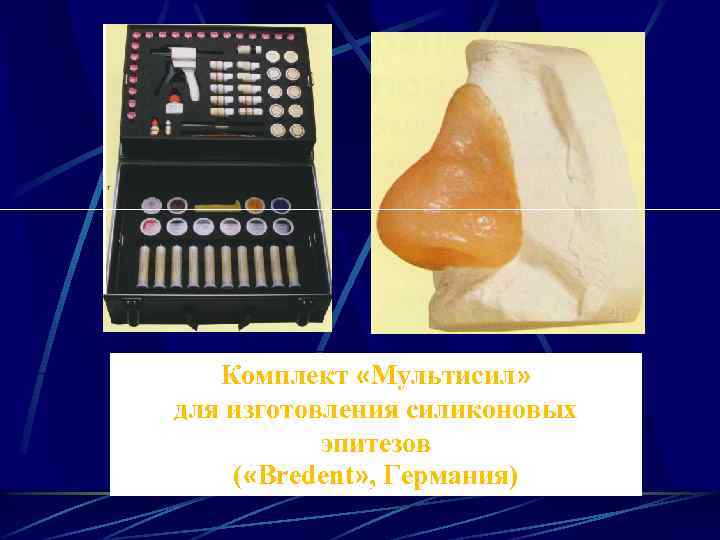 Комплект «Мультисил» для изготовления силиконовых эпитезов ( «Bredent» , Германия) 