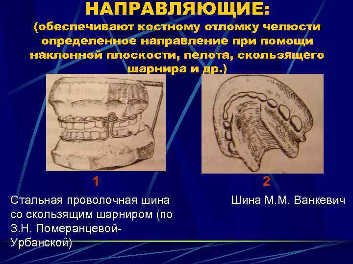 Направляющие обеспечивают