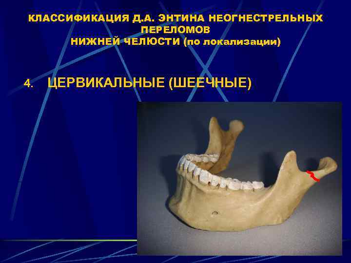 Кафедра ортопедической стоматологии