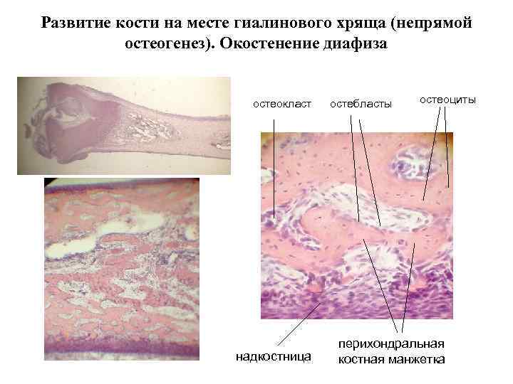 Развитие кости на месте гиалинового хряща (непрямой остеогенез). Окостенение диафиза остеокласт надкостница остебласты остеоциты