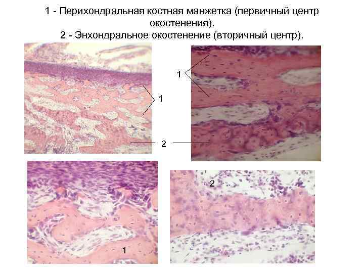 1 - Перихондральная костная манжетка (первичный центр окостенения). 2 - Энхондральное окостенение (вторичный центр).