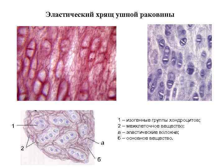 Эластический хрящ ушной раковины 1 а 2 б 1 – изогенные группы хондроцитов; 2