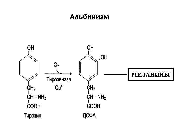 Альбинизм МЕЛАНИНЫ 