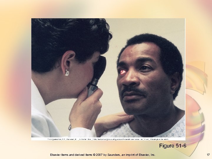 Figure 51 -6 Elsevier items and derived items © 2007 by Saunders, an imprint