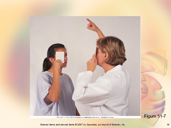 Figure 51 -7 Elsevier items and derived items © 2007 by Saunders, an imprint