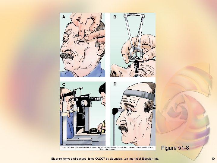 Figure 51 -8 Elsevier items and derived items © 2007 by Saunders, an imprint