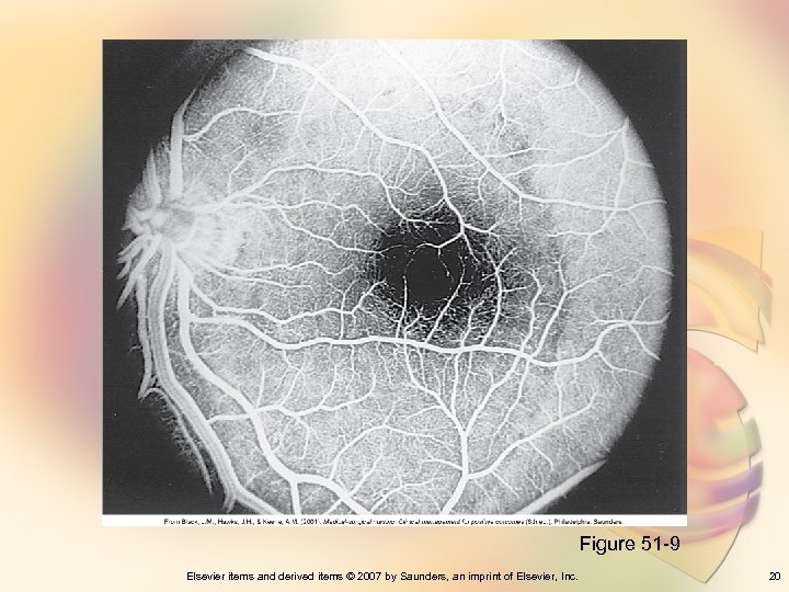 Figure 51 -9 Elsevier items and derived items © 2007 by Saunders, an imprint