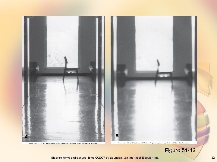 Figure 51 -12 Elsevier items and derived items © 2007 by Saunders, an imprint