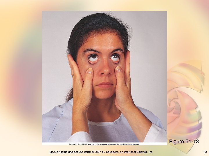 Figure 51 -13 Elsevier items and derived items © 2007 by Saunders, an imprint