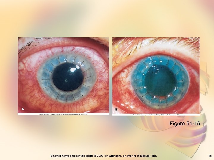 Figure 51 -15 Elsevier items and derived items © 2007 by Saunders, an imprint