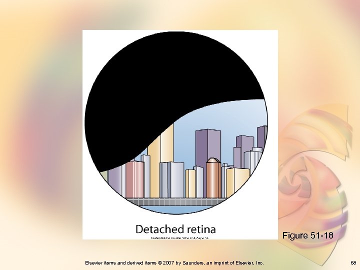 Figure 51 -18 Elsevier items and derived items © 2007 by Saunders, an imprint