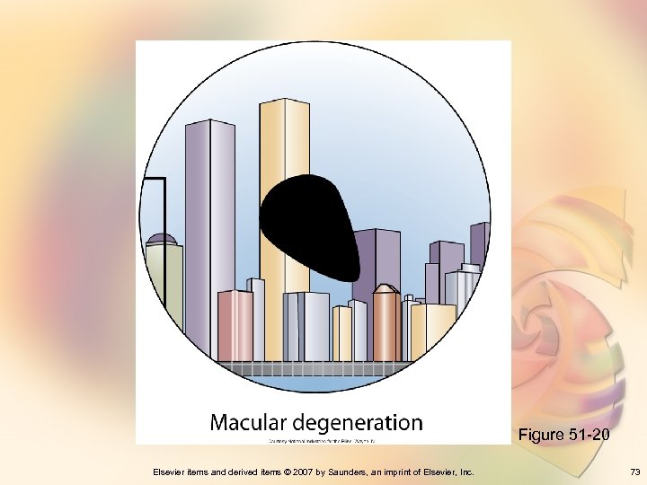 Figure 51 -20 Elsevier items and derived items © 2007 by Saunders, an imprint