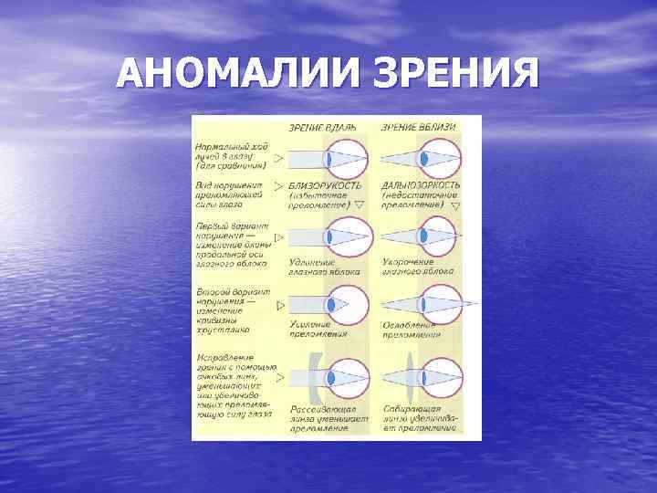 АНОМАЛИИ ЗРЕНИЯ 