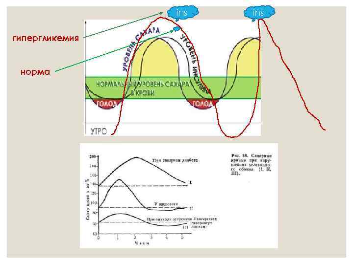 ins гипергликемия норма ins 