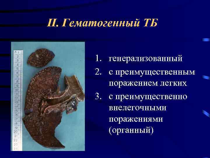 II. Гематогенный ТБ 1. генерализованный 2. с преимущественным поражением легких 3. с преимущественно внелегочными