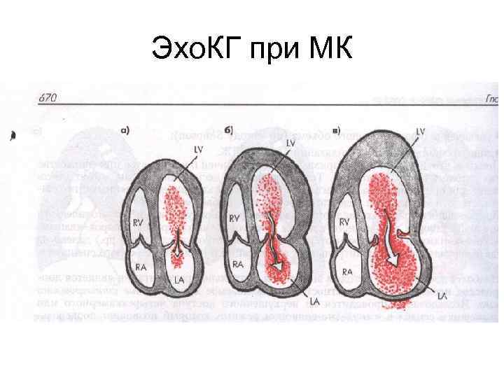 Как делают эхо кг сердца женщинам фото