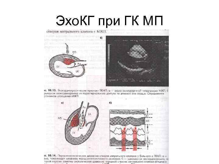 Эхо. КГ при ГК МП 