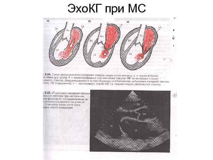 Эхокг в таблицах и схемах рыбакова