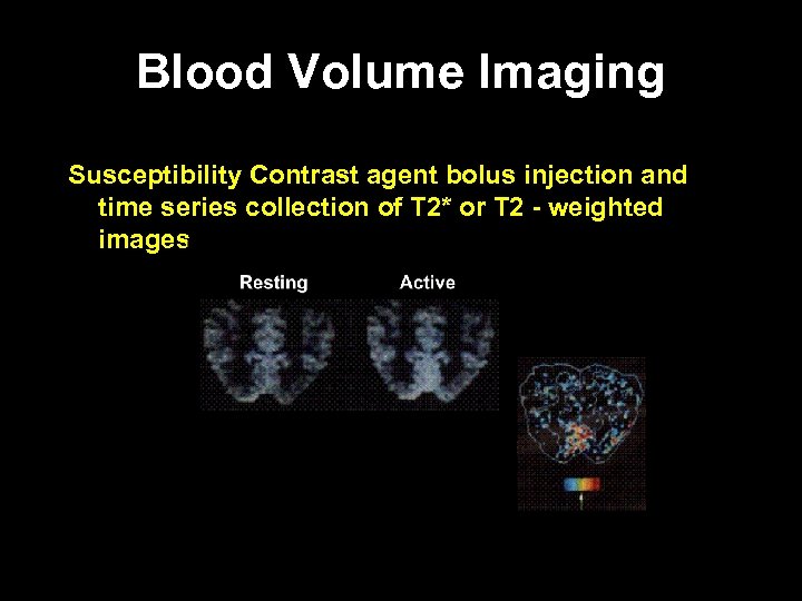 Blood Volume Imaging Susceptibility Contrast agent bolus injection and time series collection of T