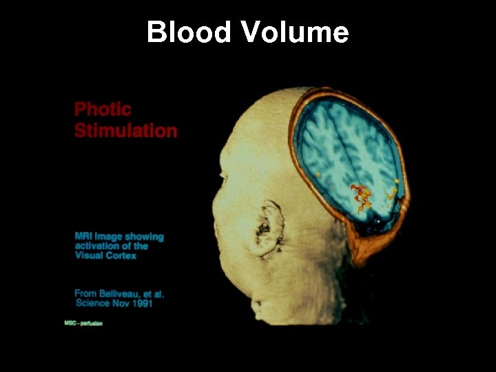 Blood Volume 