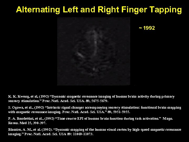 Alternating Left and Right Finger Tapping ~ 1992 K. K. Kwong, et al, (1992)