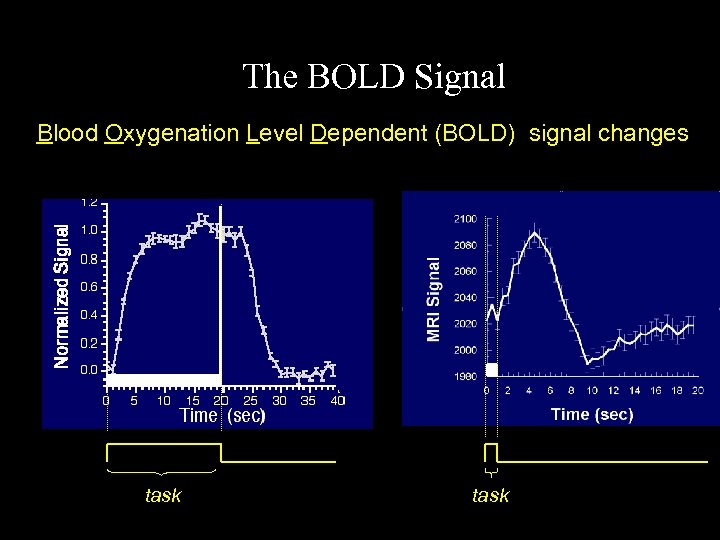 The BOLD Signal Blood Oxygenation Level Dependent (BOLD) signal changes task 