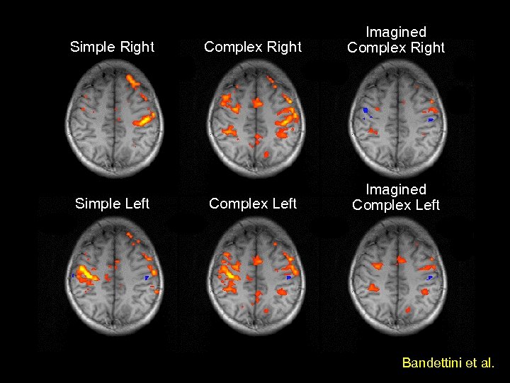 Simple Right Simple Left Complex Right Imagined Complex Right Complex Left Imagined Complex Left