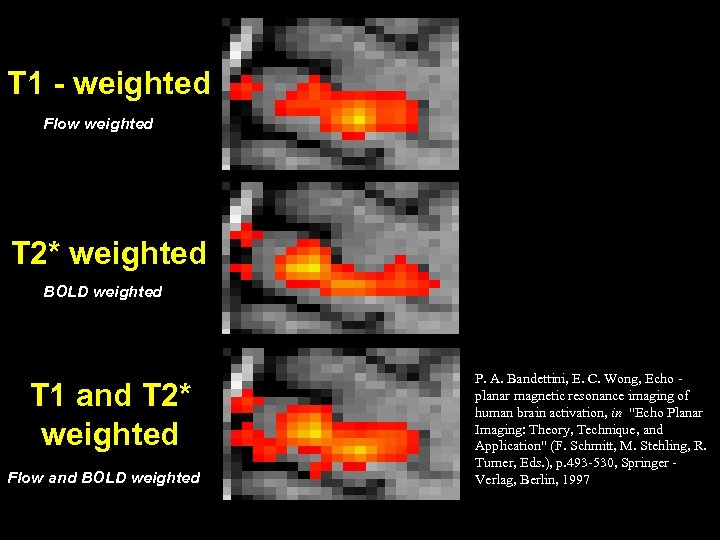 T 1 - weighted Flow weighted T 2* weighted BOLD weighted T 1 and