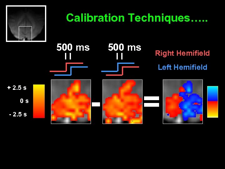 Calibration Techniques…. . 500 ms Right Hemifield Left Hemifield + 2. 5 s 0