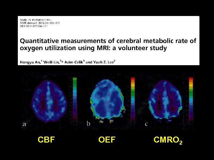 CBF OEF CMRO 2 