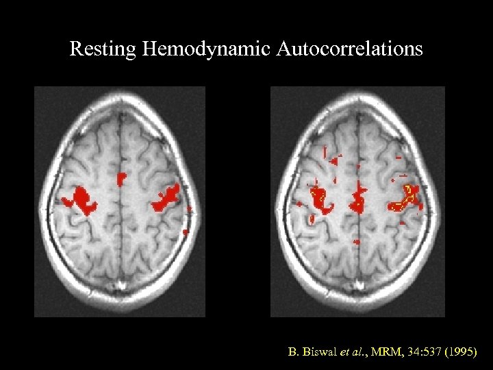 Resting Hemodynamic Autocorrelations conventional BOLD map low frequency autocorrelation map B. Biswal et al.