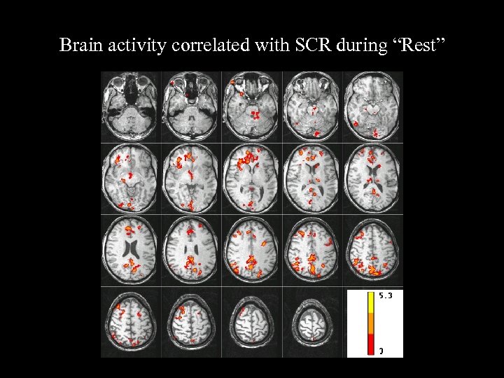 Brain activity correlated with SCR during “Rest” 