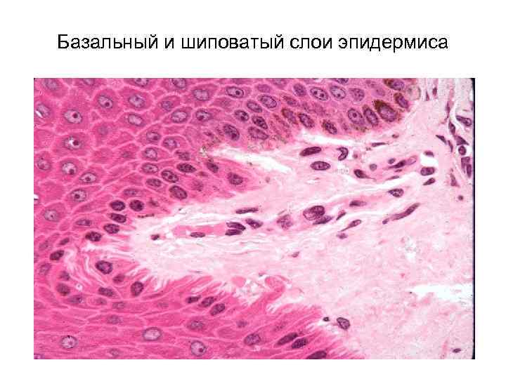 Базальный и шиповатый слои эпидермиса 