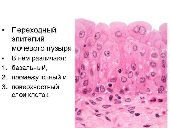  • Переходный эпителий мочевого пузыря. • 1. 2. 3. В нём различают: базальный,