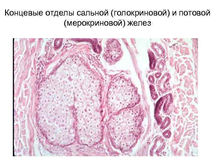 Концевые отделы сальной (голокриновой) и потовой (мерокриновой) желез 
