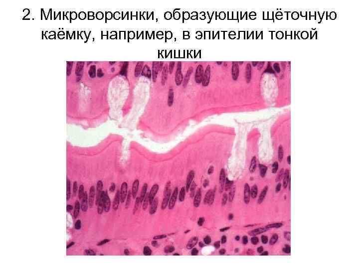 2. Микроворсинки, образующие щёточную каёмку, например, в эпителии тонкой кишки 