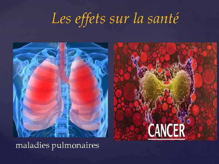 Les effets sur la santé maladies pulmonaires 