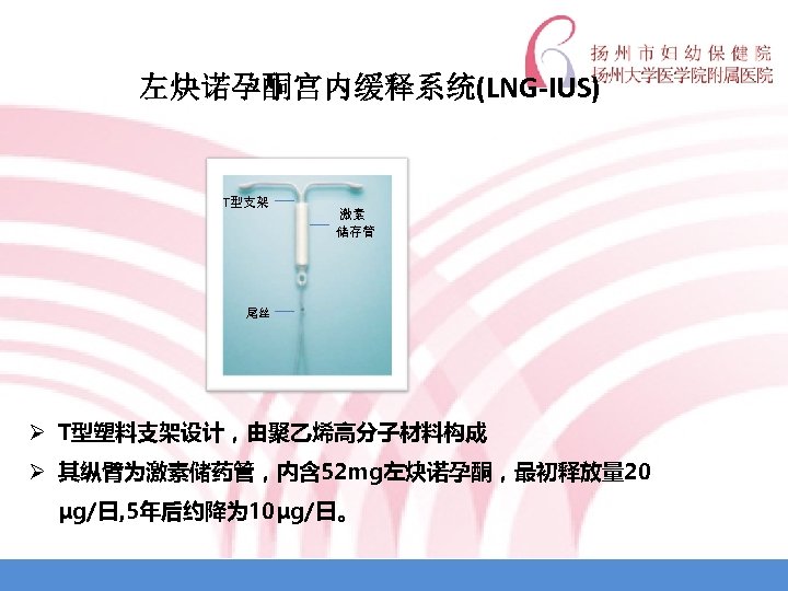 左炔诺孕酮宫内缓释系统(LNG-IUS) T型支架 激素 储存管 尾丝 Ø T型塑料支架设计，由聚乙烯高分子材料构成 Ø 其纵臂为激素储药管，内含 52 mg左炔诺孕酮，最初释放量 20 μg/日, 5年后约降为