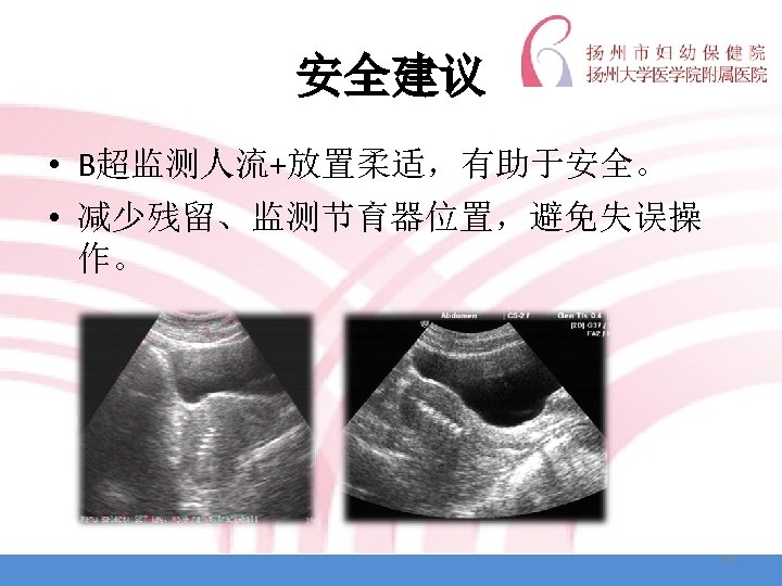 安全建议 • B超监测人流+放置柔适，有助于安全。 • 减少残留、监测节育器位置，避免失误操 作。 54 