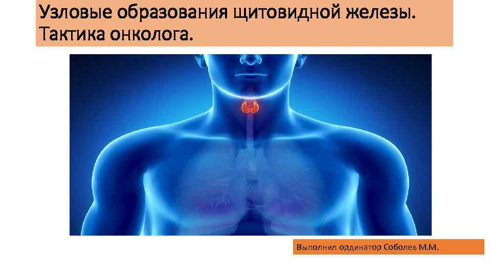 Узловые образования щитовидной железы. Тактика онколога. Выполнил ординатор Соболев М. М. 