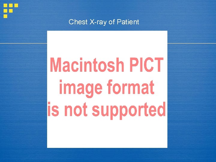 Chest X-ray of Patient 