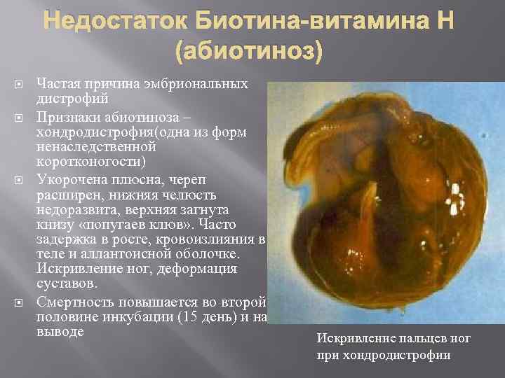 Недостаток Биотина-витамина Н (абиотиноз) Частая причина эмбриональных дистрофий Признаки абиотиноза – хондродистрофия(одна из форм