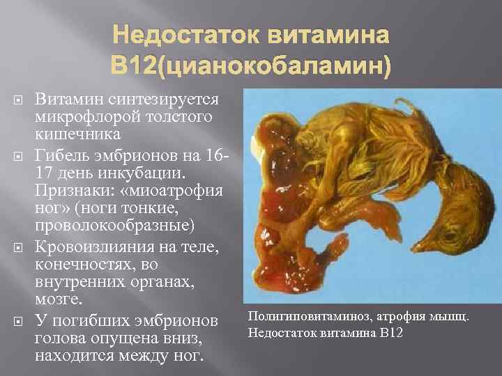 Недостаток витамина В 12(цианокобаламин) Витамин синтезируется микрофлорой толстого кишечника Гибель эмбрионов на 1617 день