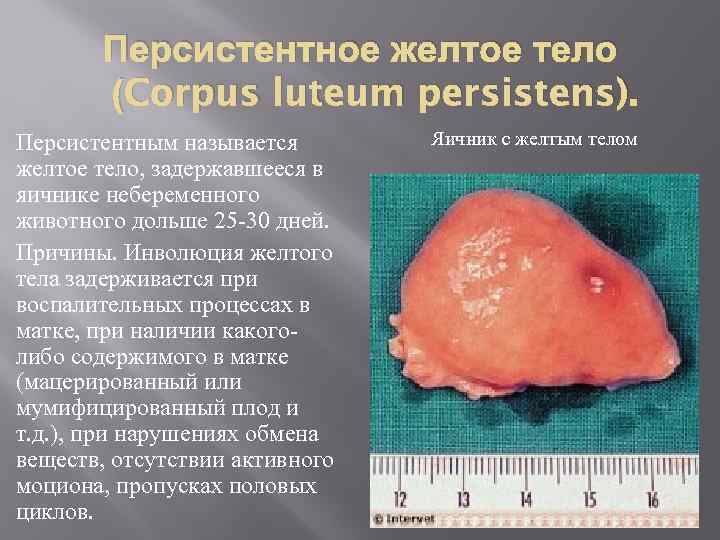 Персистентное желтое тело (Corpus luteum persistens). Персистентным называется желтое тело, задержавшееся в яичнике небеременного