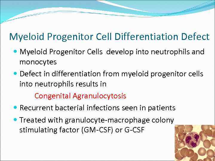 Myeloid Progenitor Cell Differentiation Defect Myeloid Progenitor Cells develop into neutrophils and monocytes Defect