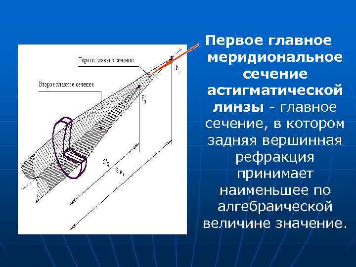 Задней вершинной рефракции