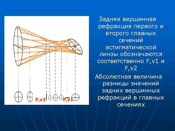 F, v 2 F, v 1 Задняя вершинная рефракция первого и второго главных сечений
