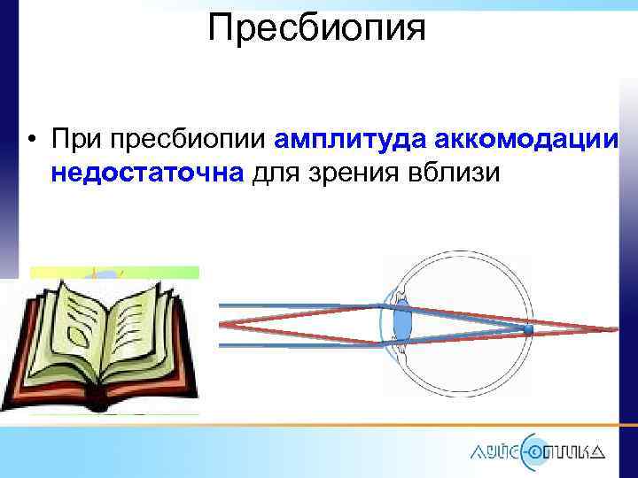 Пресбиопия • При пресбиопии амплитуда аккомодации недостаточна для зрения вблизи 