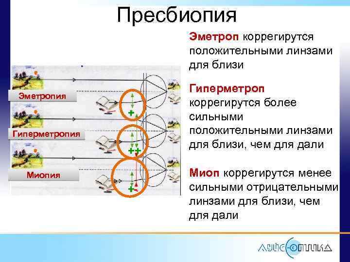 Пресбиопия Эметроп коррегирутся положительными линзами для близи Эметропия + Гиперметропия ++ Миопия +- Гиперметроп